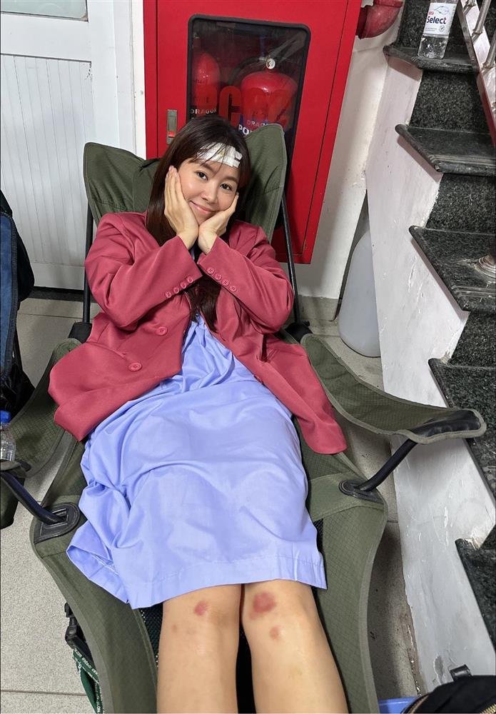 Lê Phương băng đầu bầm chân, ai nhìn cũng xót-2