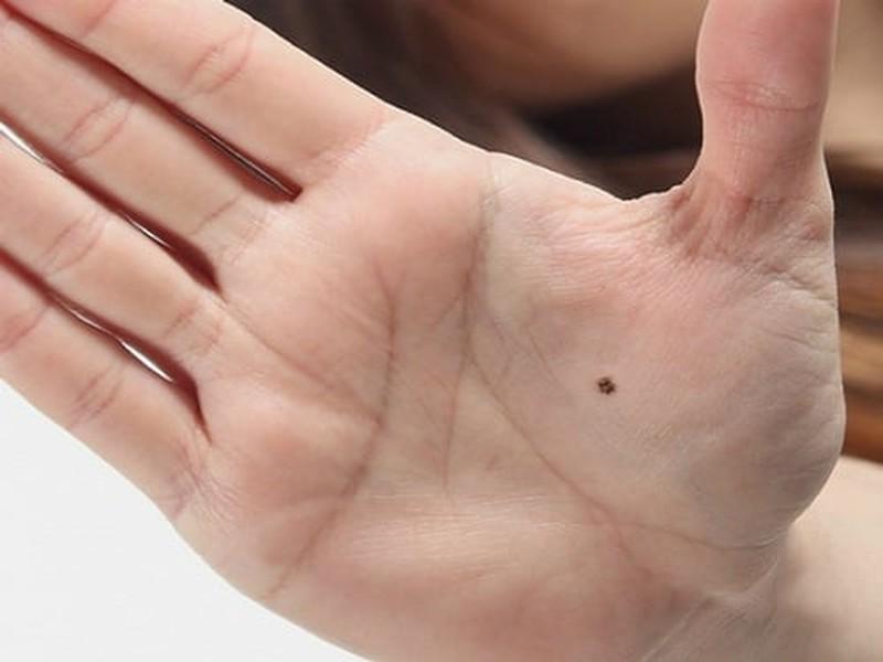 4 nốt ruồi giàu sang trên cơ thể: Có 1/4 cũng sung túc cả đời-1