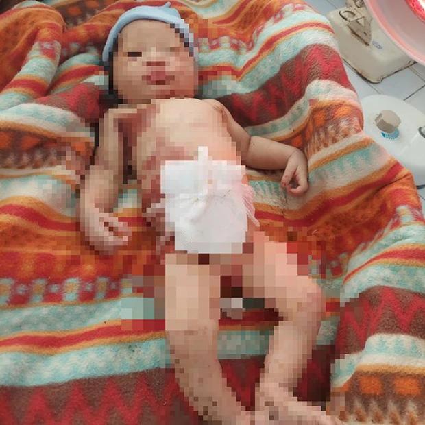 Quảng Nam: Bé sơ sinh bị bỏ rơi giữa rừng, giòi bám đầy người-2