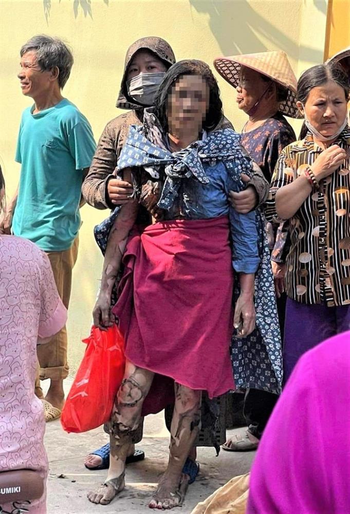 Vụ 3 con gái tưới xăng đốt nhà mẹ: Con gái cả đã tử vong-2