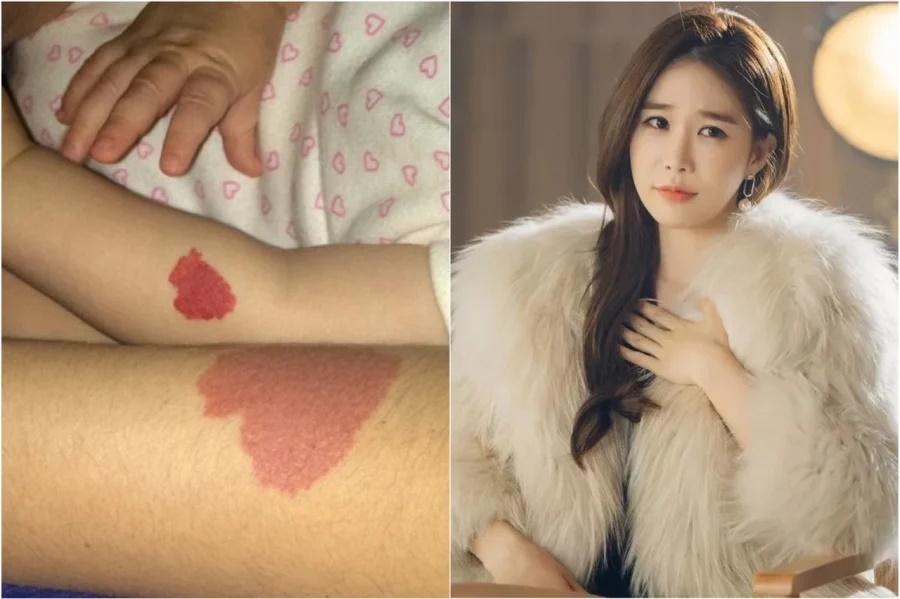 Vết bớt tiền kiếp nhưng dự đoán tương lai, vết bớt ở đâu đại vận khí?-1