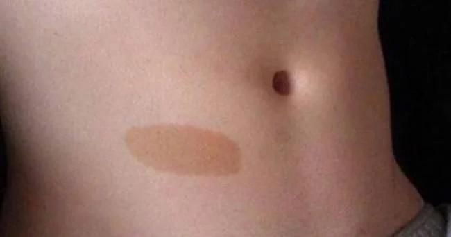 Vết bớt tiền kiếp nhưng dự đoán tương lai, vết bớt ở đâu đại vận khí?-3