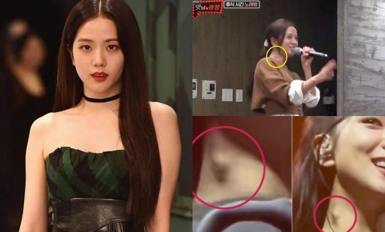 Bác sĩ cảnh báo Jisoo BLACKPINK cần phẫu thuật càng sớm càng tốt-2