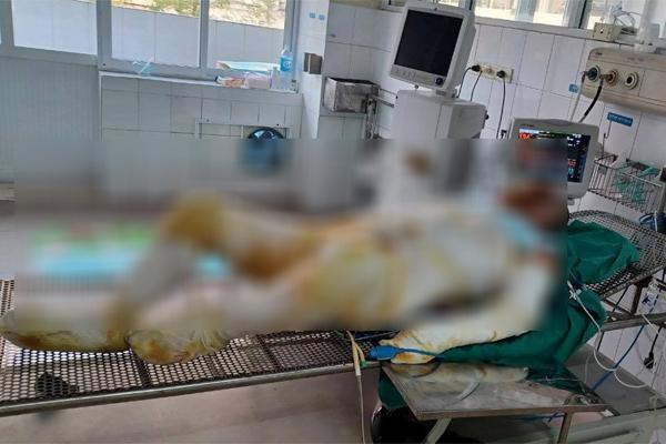 Vụ 3 con gái tưới xăng đốt nhà mẹ: Con gái cả đã tử vong-1