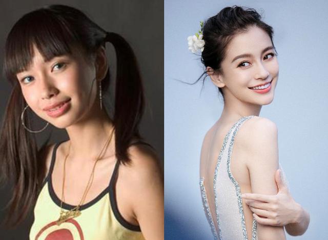 Angelababy kiện bệnh viện vì loạt ảnh thời chưa chỉnh răng-1