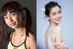 Angelababy kiện bệnh viện vì loạt ảnh thời chưa chỉnh răng