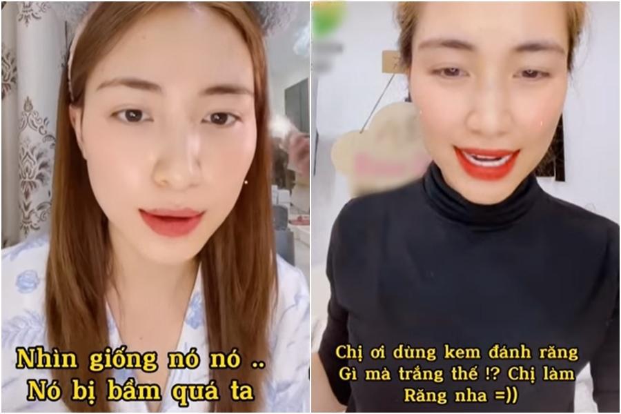 Mặt mộc Hòa Minzy thế nào sau nhiều lần toang nặng vì mụn?-14