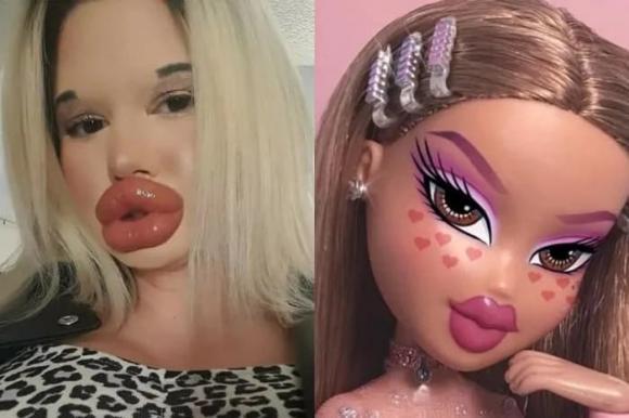 Giật mình đôi môi dày nhất thế giới của cô gái nghiện thẩm mỹ-3