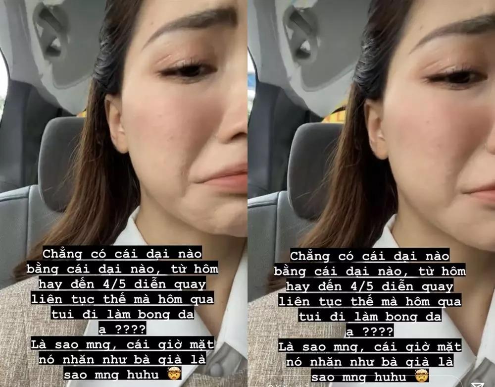 Mặt mộc Hòa Minzy thế nào sau nhiều lần toang nặng vì mụn?-6