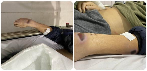 Hãi hùng cách nhục hình của 2 cựu công an khiến bị can tử vong-1