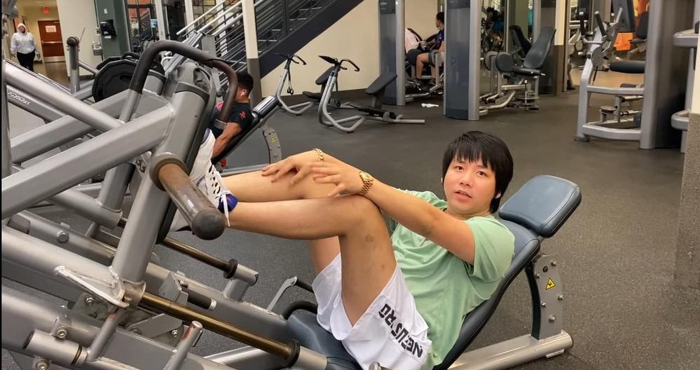 Giật mình đôi chân đầy sẹo Khoa Pug khi chi 5 tỷ tăng chiều cao-5