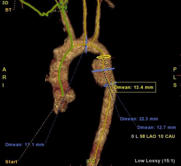 Leo ra ngoài lau cửa sổ, người phụ nữ tuột tay rơi từ tầng 5-2