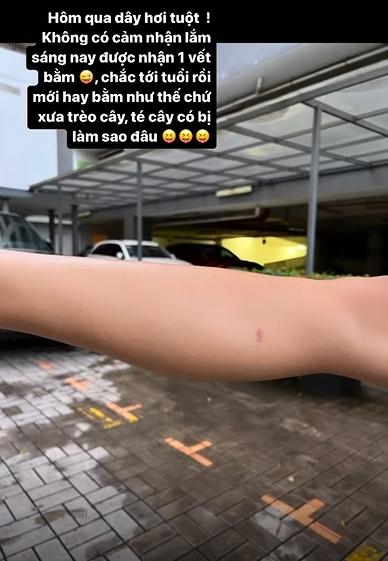 HHen Niê bị thương vì giày tuột dây, phải dỗ bạn diễn khi catwalk-2