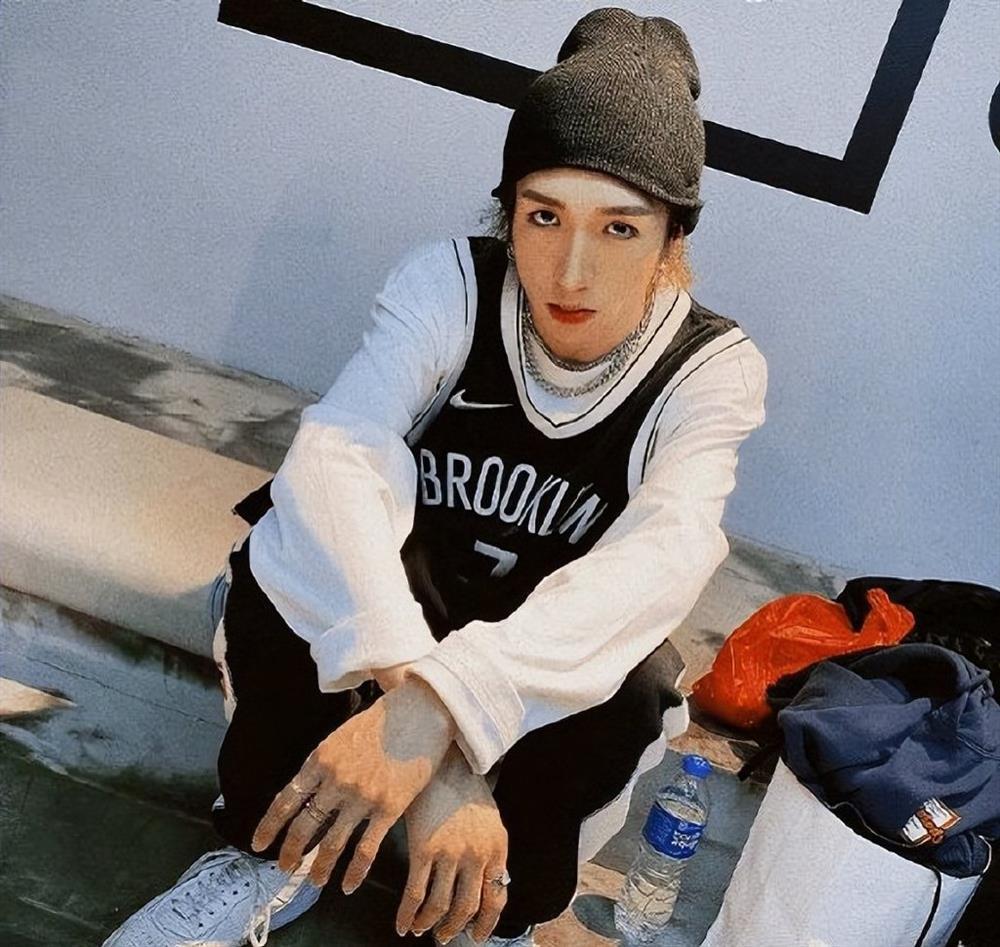 Vũ công bị màn hình 600 kg rơi trúng người không thể chữa khỏi-3