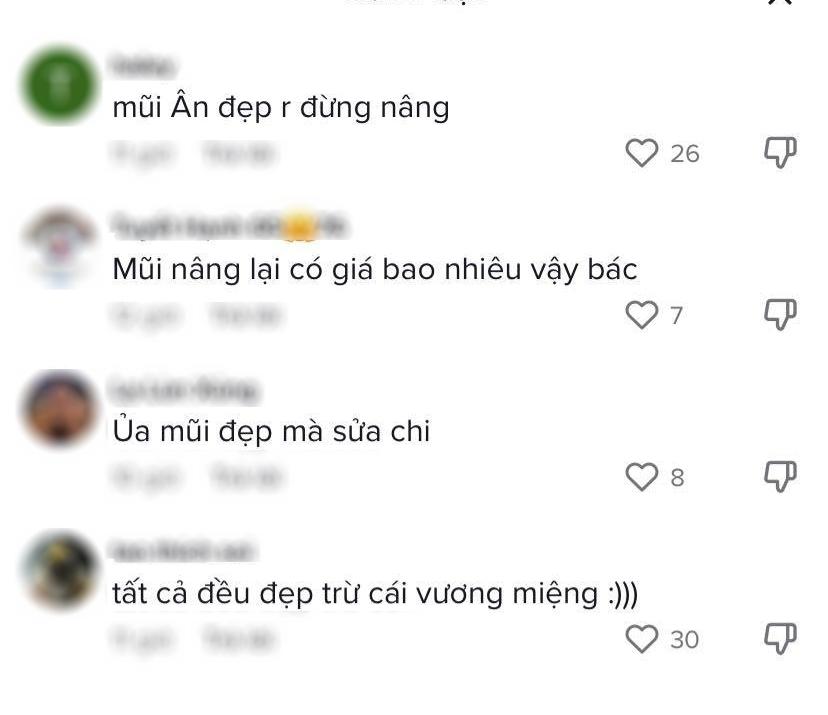 Thiên Ân định nâng mũi: Netizen kịch liệt phản đối-4