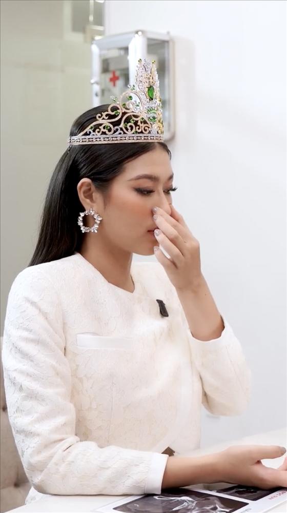 Thiên Ân định nâng mũi: Netizen kịch liệt phản đối-3