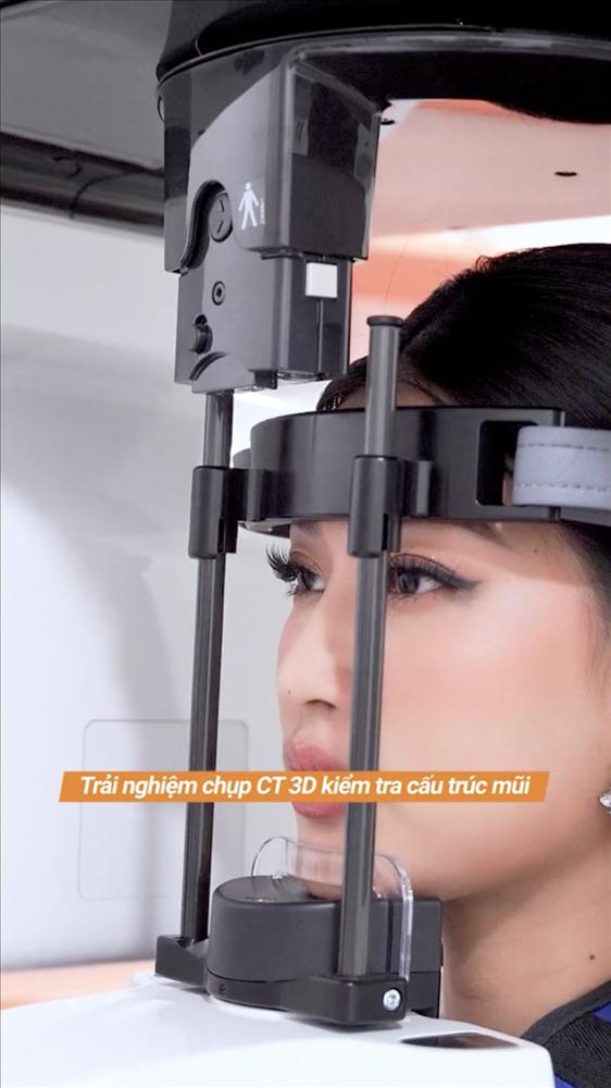 Thiên Ân định nâng mũi: Netizen kịch liệt phản đối-2