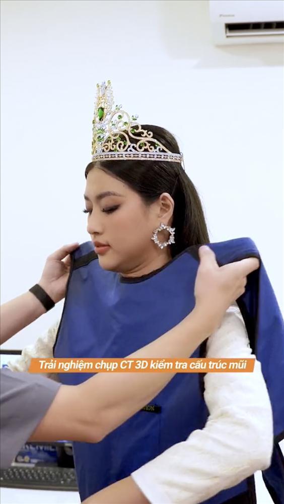 Thiên Ân định nâng mũi: Netizen kịch liệt phản đối-1