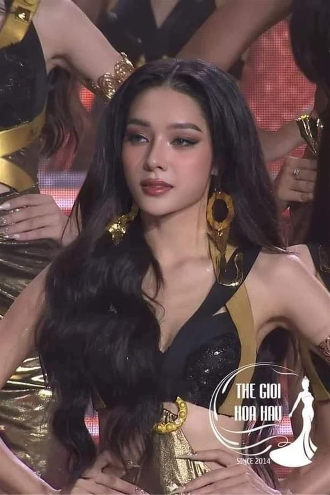 Thiên Ân định nâng mũi: Netizen kịch liệt phản đối-7