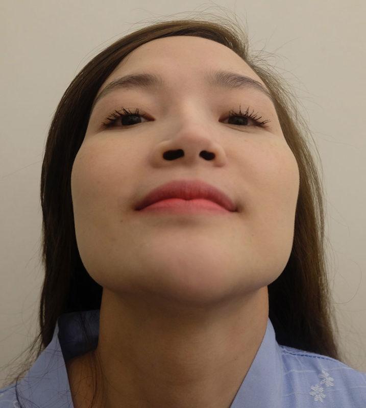 Nhìn cánh mũi, đoán được số dư tài khoản đang nhảy mấy số-1