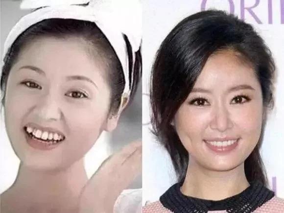 Dàn mỹ nhân Hoa ngữ vịt hóa thiên nga nhờ chỉnh sửa 1 bộ phận-3