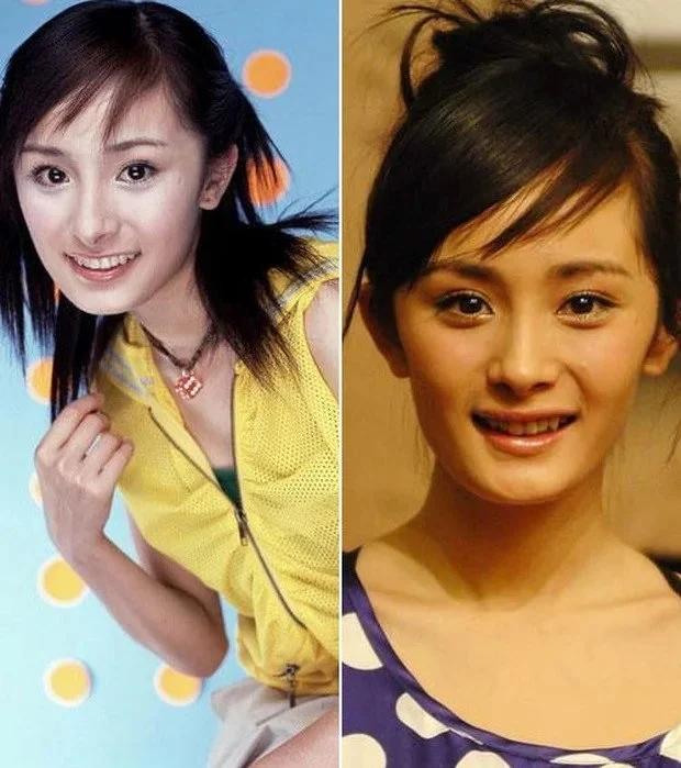 Dàn mỹ nhân Hoa ngữ vịt hóa thiên nga nhờ chỉnh sửa 1 bộ phận-7