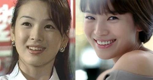 Dàn mỹ nhân Hoa ngữ vịt hóa thiên nga nhờ chỉnh sửa 1 bộ phận-8