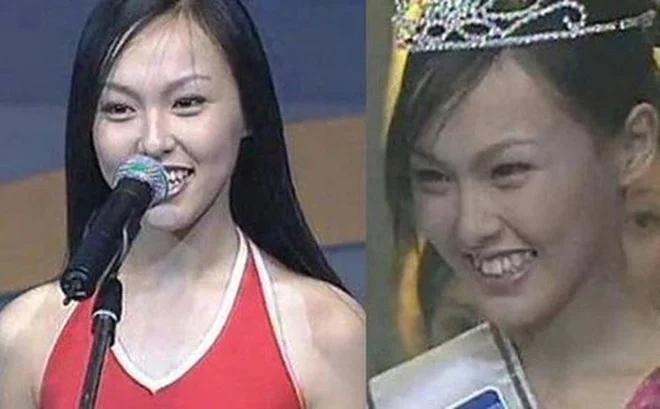 Dàn mỹ nhân Hoa ngữ vịt hóa thiên nga nhờ chỉnh sửa 1 bộ phận-9