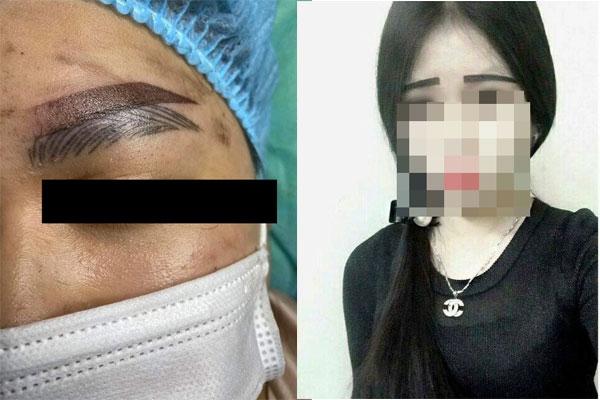 Cấy lông mày chanh sả, người phụ nữ nhận thành quả đớn đau-6