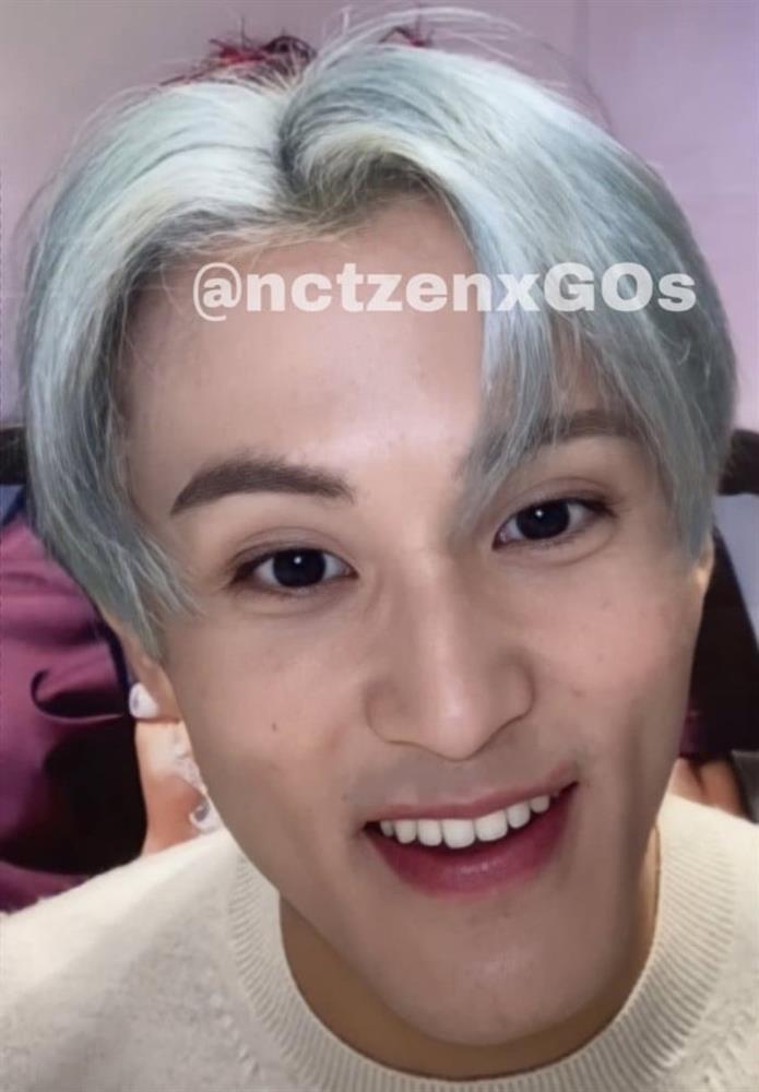 Mark (NCT) bị phản ứng vì để râu tóc luộm thuộm đi gặp fan-2