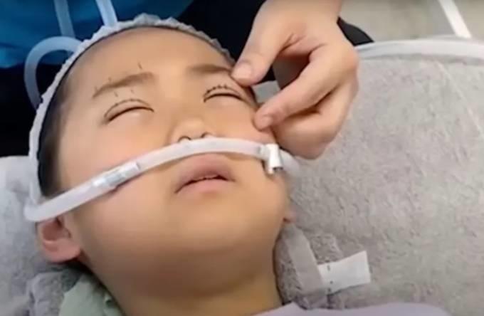Bé gái 9 tuổi được mẹ đưa đi cắt mí-1