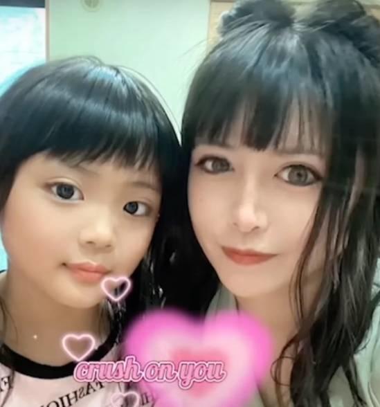 Bé gái 9 tuổi được mẹ đưa đi cắt mí-3