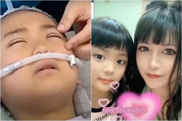 Suýt hỏng mắt sau khi làm chuột bạch cho học viên thử việc cắt mí-3