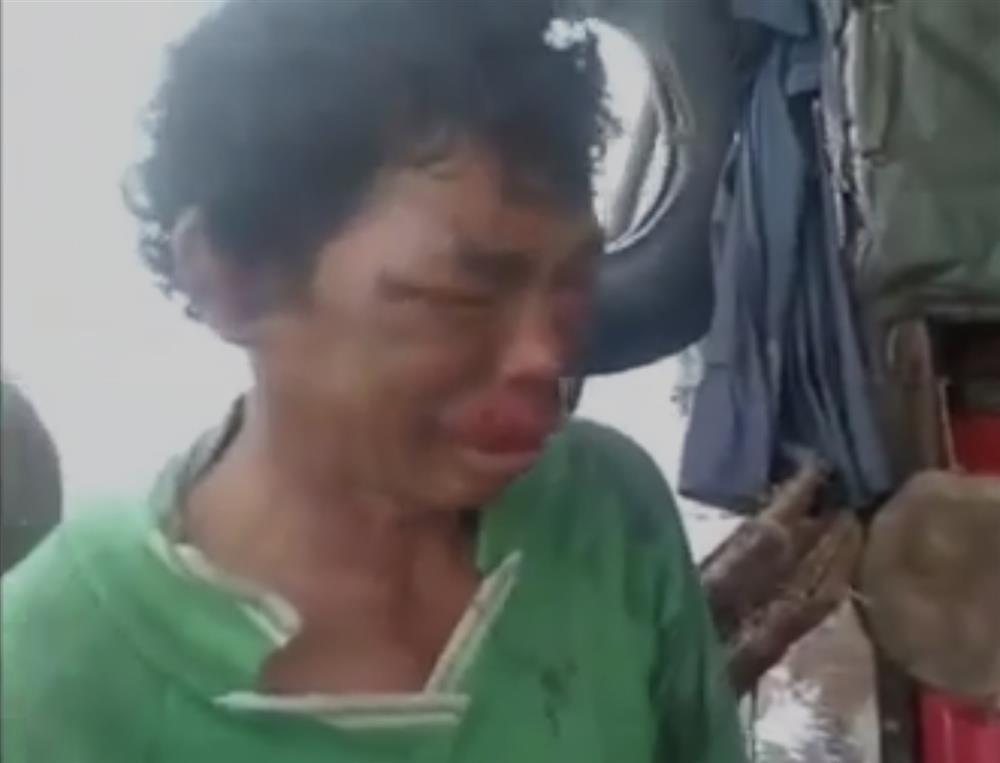 Clip: Người đàn ông bị tra tấn dã man bằng kìm bấm vào cơ thể-1