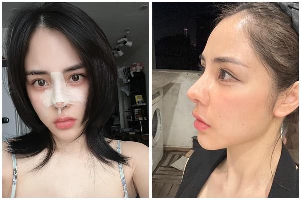 Huỳnh Anh đứng hình khi bị người tình hơn tuổi soi dung mạo-8