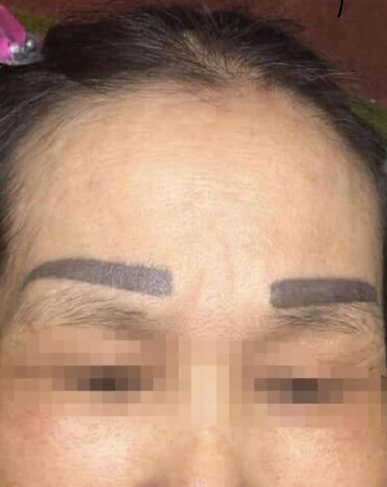 Cấy lông mày chanh sả, người phụ nữ nhận thành quả đớn đau-3