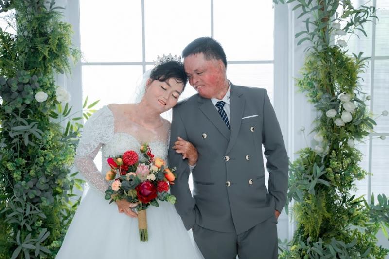 Hạnh phúc ngọt ngào của người phụ nữ từng bị thiêu sống-1