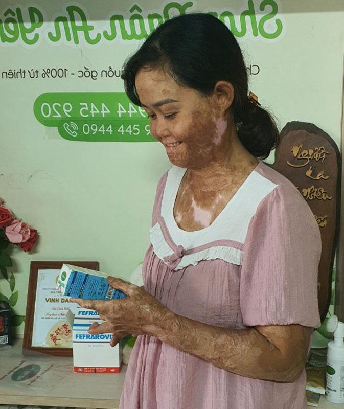 Hạnh phúc ngọt ngào của người phụ nữ từng bị thiêu sống-3