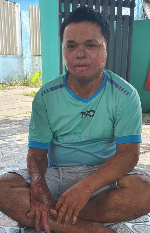 Hạnh phúc ngọt ngào của người phụ nữ từng bị thiêu sống-4