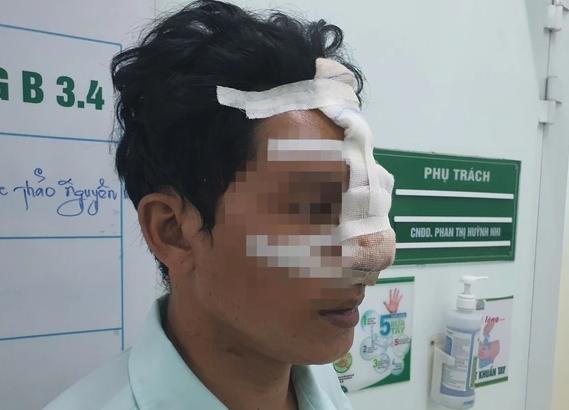 Ngăn bạn nhậu đánh nhau, người đàn ông bị cắn đứt mũi-2