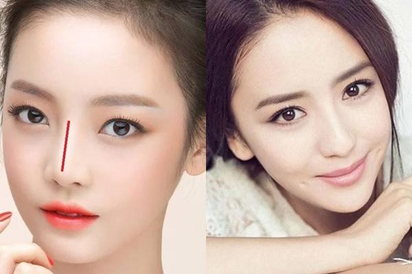 4 nốt ruồi điềm báo cát tường, ai sở hữu thường giàu sang-4