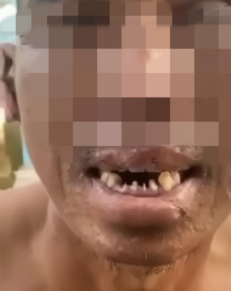 Xôn xao clip ngư dân kể bị đánh dập thịt, bẻ răng, bắt ăn cá sống-1