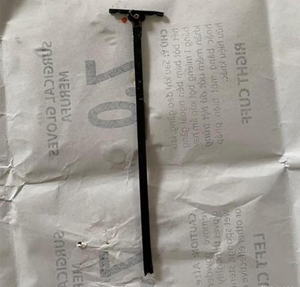 Hãi hùng bé gái 4 tuổi bị thanh sắt đâm xuyên miệng-2