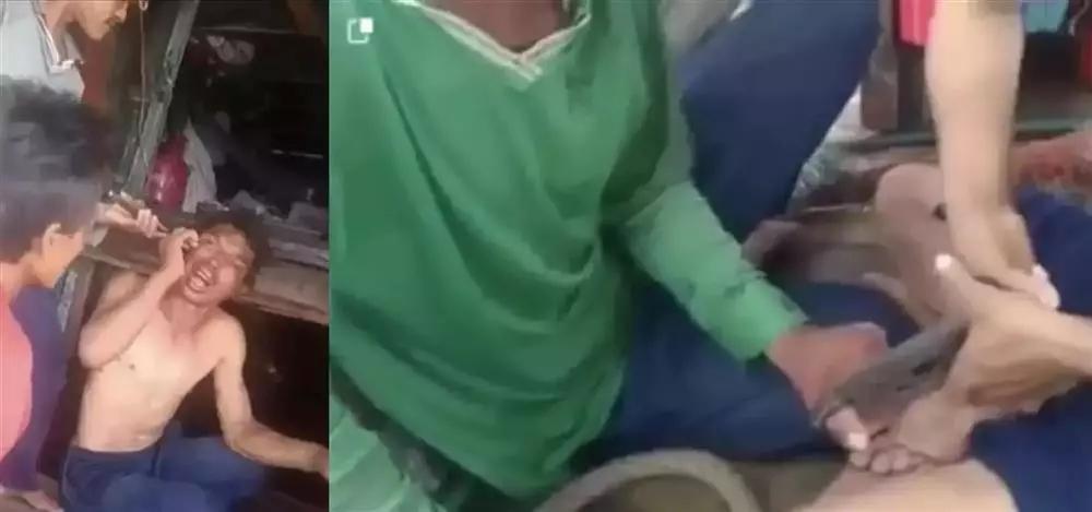 Bắt khẩn cấp 3 kẻ dùng kìm bẻ răng, tra tấn 2 ngư dân-2