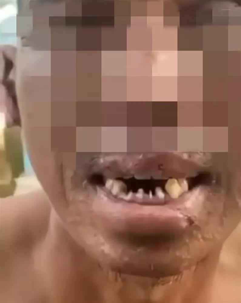 Bắt khẩn cấp 3 kẻ dùng kìm bẻ răng, tra tấn 2 ngư dân-3