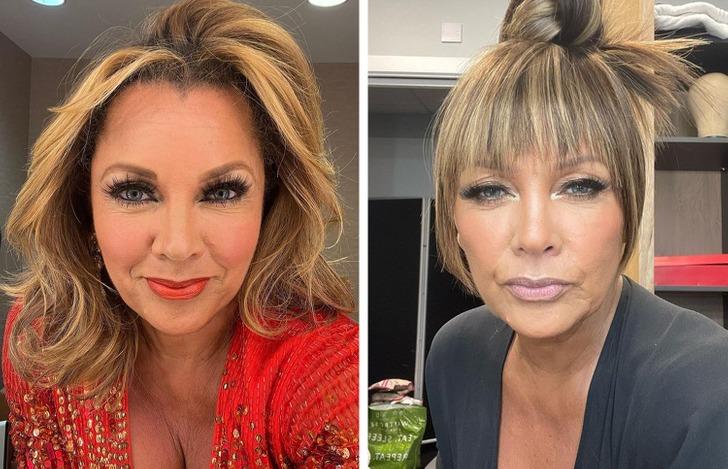 6 sao Hollywood tự tin hơn nhờ phẫu thuật thẩm mỹ-2