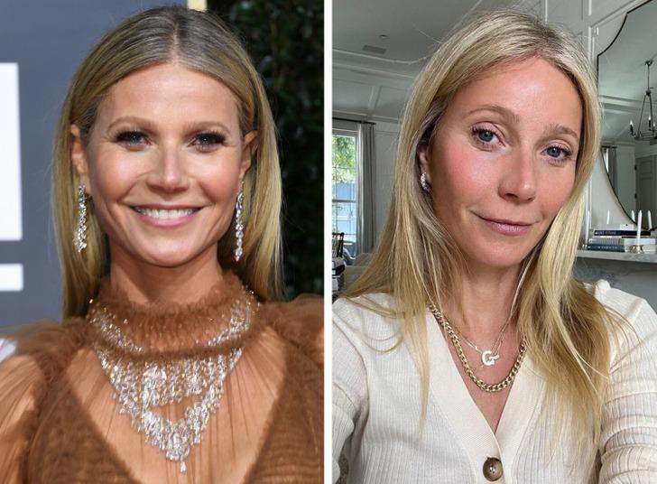 6 sao Hollywood tự tin hơn nhờ phẫu thuật thẩm mỹ-5