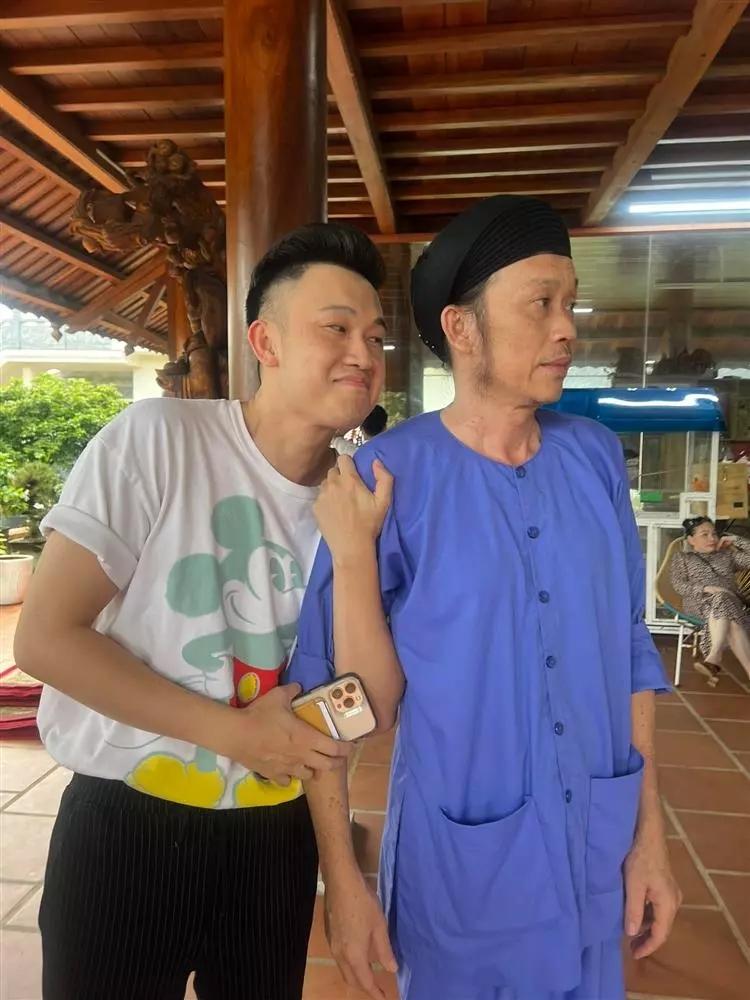 Hoài Linh liên tục lộ ngoại hình hom hem khi comeback-8