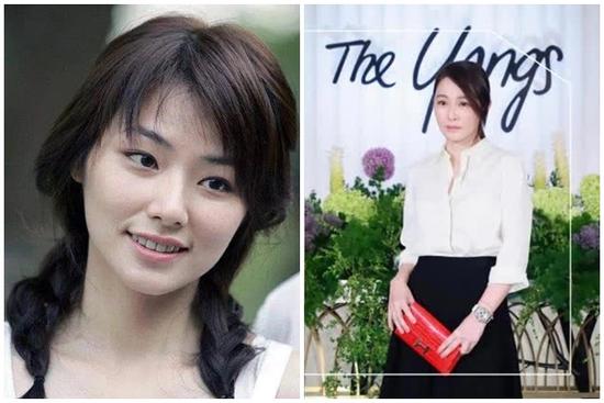 Mỹ nhân phim thần tượng ngoại tình với bác sĩ thẩm mỹ