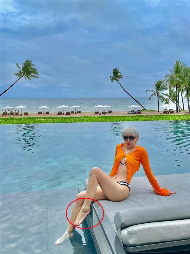 Tóc Tiên gây lo lắng vì chân sưng vù trong ảnh tự đăng-3